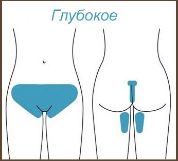 Глубокое бикини